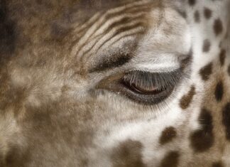 Co oznaczają ciemne plamy na nogach?